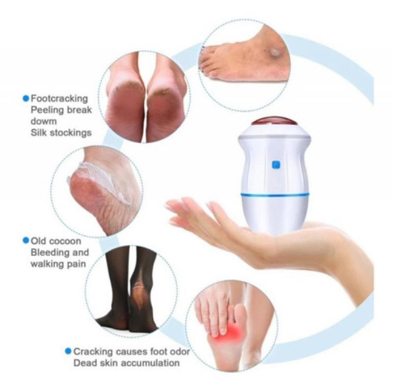 Exfoliador Removedor Electrico Saca Callos Pies Manos Usb